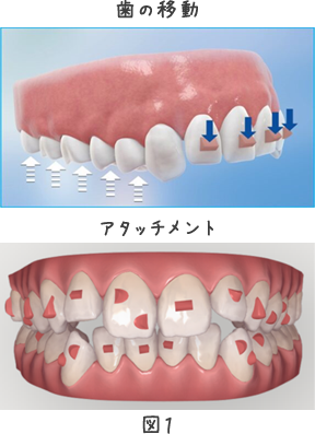 アタッチメント