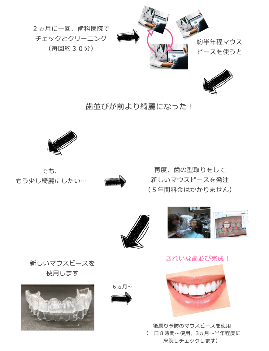 マウスピース矯正の経過